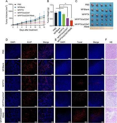 Nanomedicine based on chemotherapy-induced immunogenic death combined with immunotherapy to enhance antitumor immunity